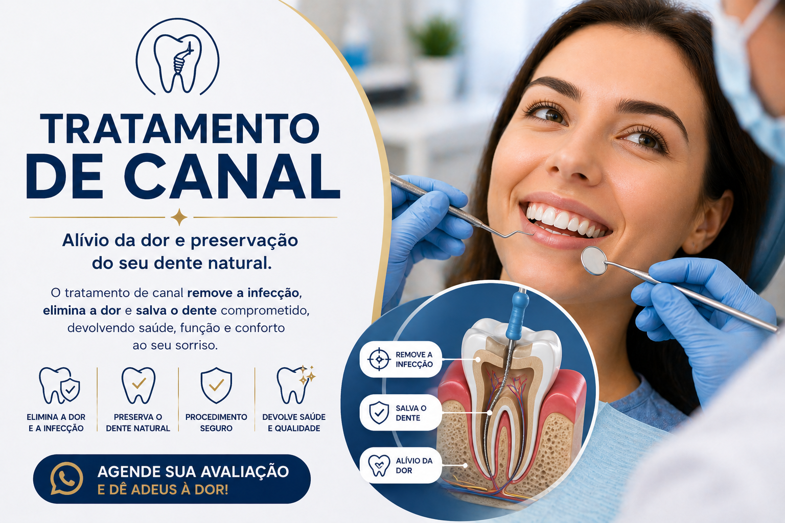 🦷 Tratamento de Canal